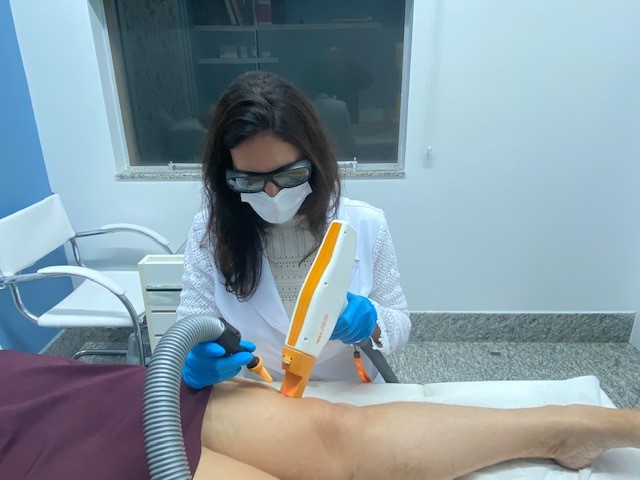 Tratamento a Laser para Vasinhos em Tatuí