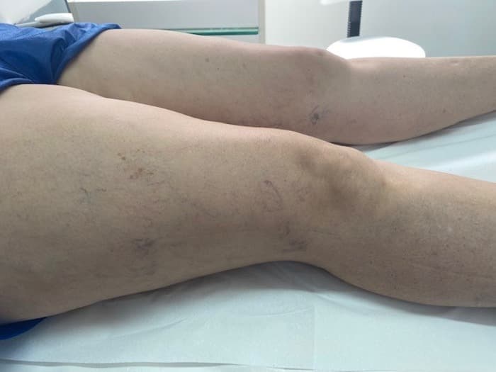 Consultório Médico Que Trata Vasinhos em Tatuí