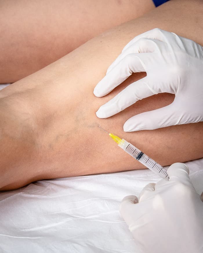 Médico Que Trata Vasinhos em Sorocaba