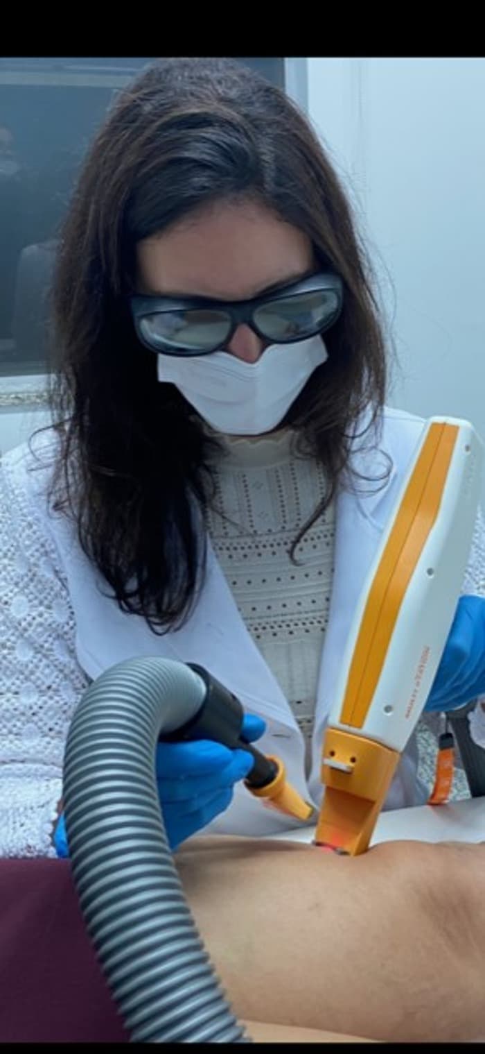 O Melhor Tratamento a Laser de Vasinhos em Sorocaba