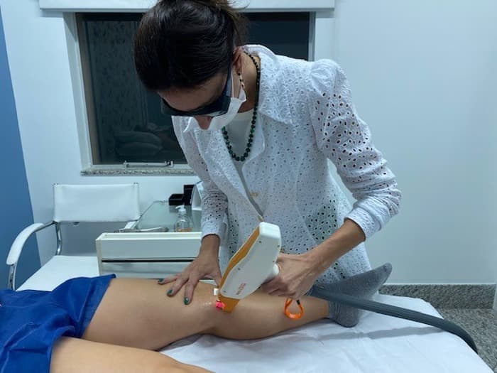 Tratamento a Laser de Vasos Nas Pernas em Tatuí