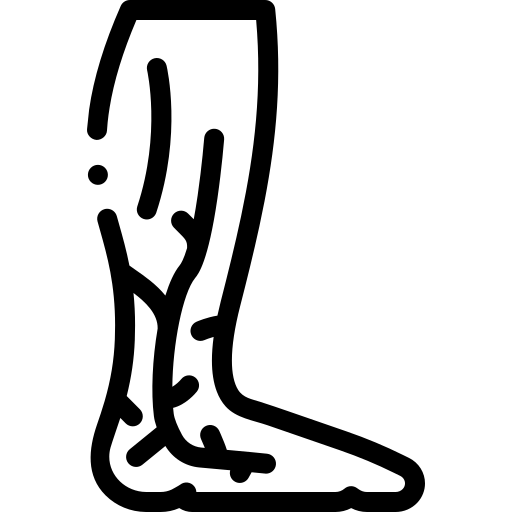 Trombose